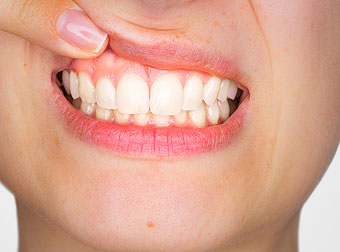 tratamentul gingiilor