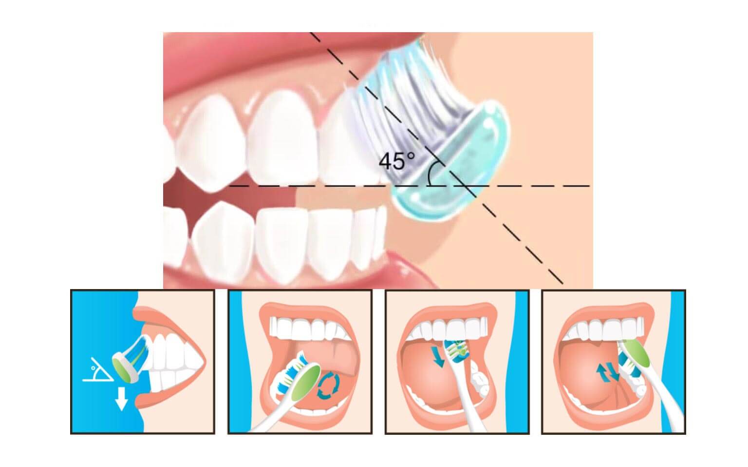 periajul-dentar-corect-arad